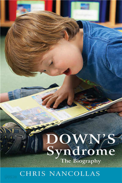 Down&#39;s Syndrome - The Biography
