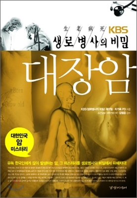 대장암