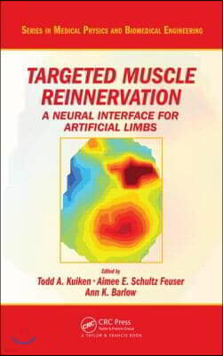 Targeted Muscle Reinnervation