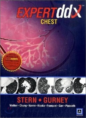 Expert Differential Diagnoses : Chest