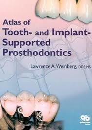 Atlas of Tooth- And Implant-Supported Prosthodontics (Hardcover)