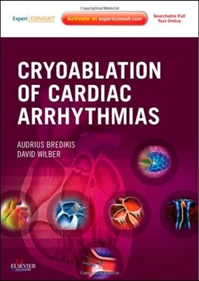 Cryoablation of Cardiac Arrhythmias