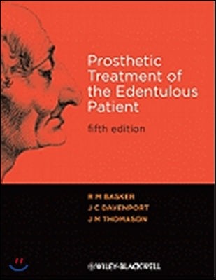 Prosthetic Treatment 5e