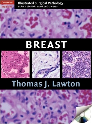 Breast [With CDROM]