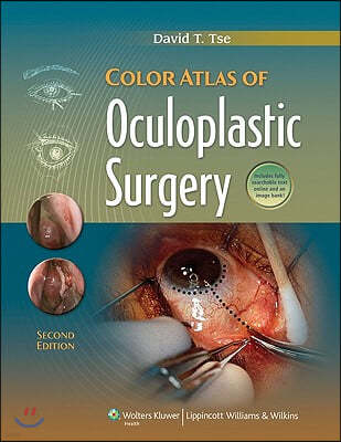 Color Atlas of Oculoplastic Surgery