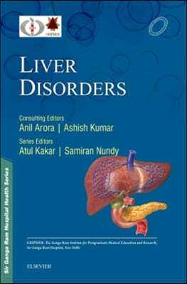 Sir Ganga Ram Hospital Health Series: Liver Disorders