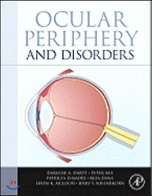 Ocular Periphery and Disorders