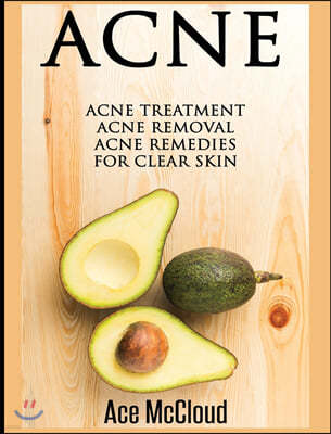 Acne: Acne Treatment: Acne Removal: Acne Remedies For Clear Skin