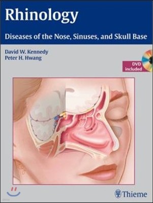 Rhinology: Diseases of the Nose, Sinuses, and Skull Base