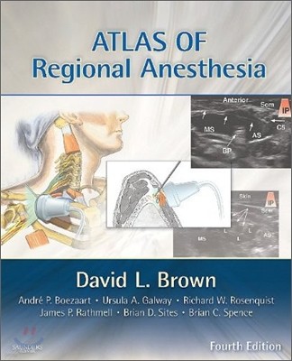 Atlas of Regional Anesthesia With Access Code, 4/E