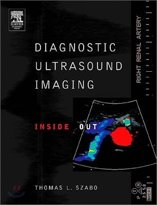 Diagnostic Ultrasound Imaging : Inside Out