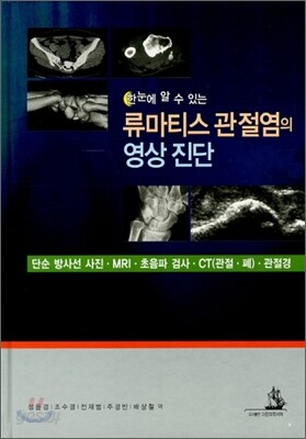 한눈에 알수있는 류마티스 관절염의 영상진단