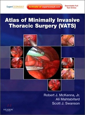 Atlas of Minimally Invasive Thoracic Surgery Vats