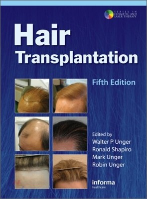 Hair Transplantation (with Procedural DVD), 5/E
