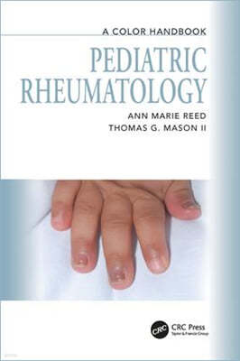 Pediatric Rheumatology