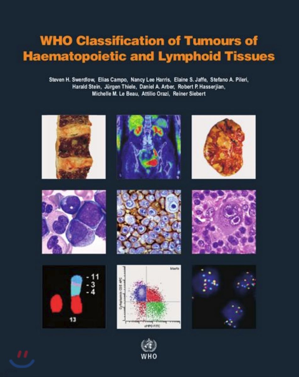 WHO classification of tumours of haematopoietic and lymphoid tissues