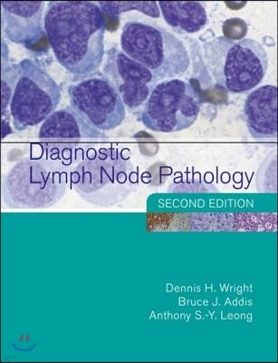 Diagnostic Lymph Node Pathology