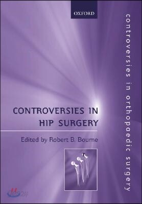 Controversies in Hip Surgery
