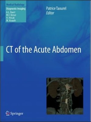 CT of the Acute Abdomen