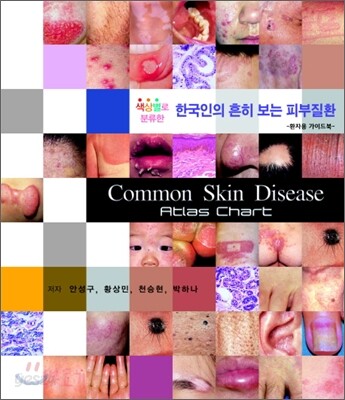 한국인의 흔히 보는 피부질환