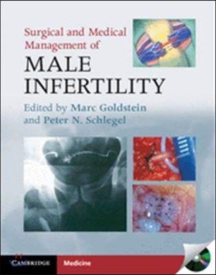 Surgical and Medical Management of Male Infertility