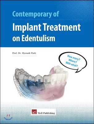 Contemporary of Implant Treatment on Edentulism