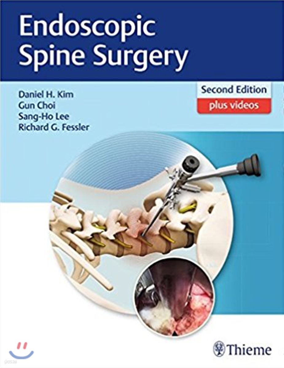 Endoscopic Spine Surgery