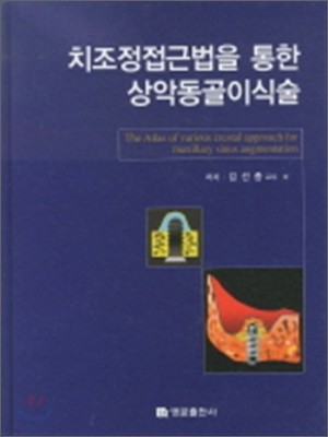 치조정접근법을 통한 상악동골이식술