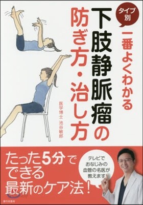 タイプ別 下肢靜脈瘤の防ぎ方.治し方