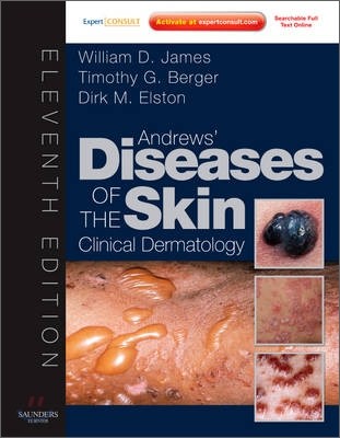 Andrews' Diseases of the Skin, 11/E: Clinical Dermatology