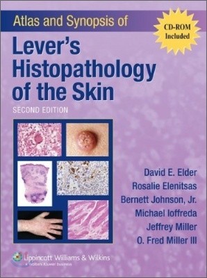 Atlas & Synopsis of Lever's Histopathology of the Skin, 2/E