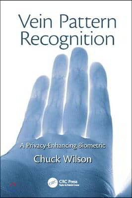 Vein Pattern Recognition