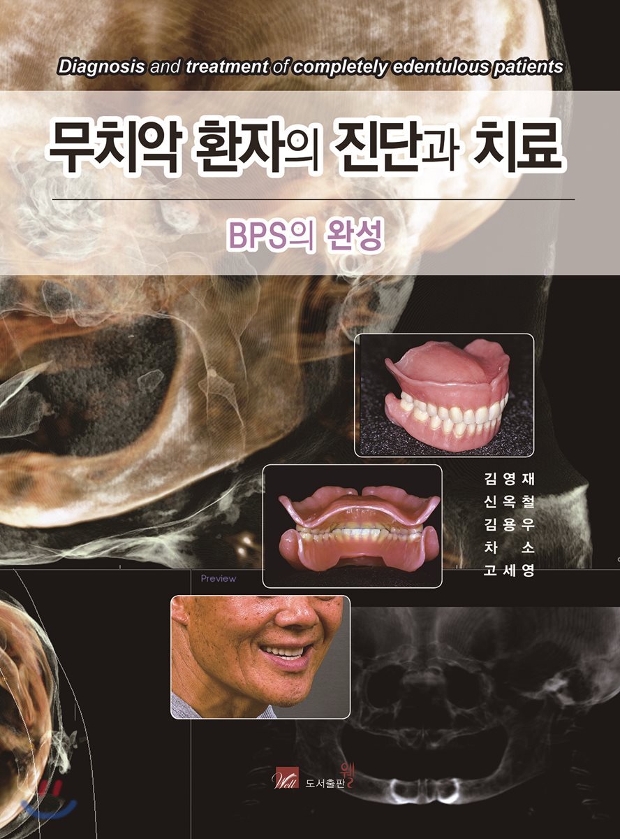 무치악 환자의 진단과 치료