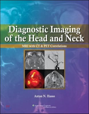 Diagnostic Imaging of the Head and Neck: MRI with CT & PET Correlations