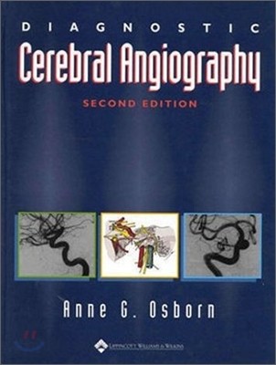 Diagnostic Cerebral Angiography