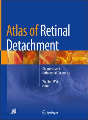 Atlas of Retinal Detachment: Diagnosis and Differential Diagnosis