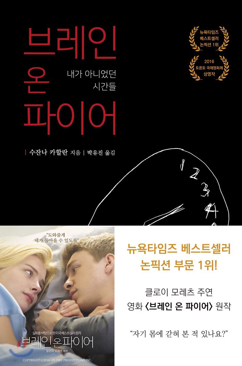 브레인 온 파이어