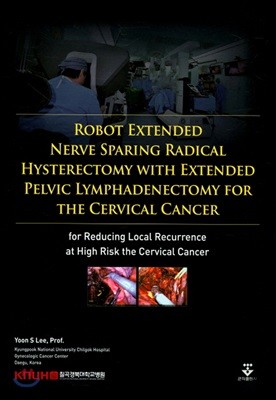 Robot Extended Nerve Sparing Radical Hysterectomy 