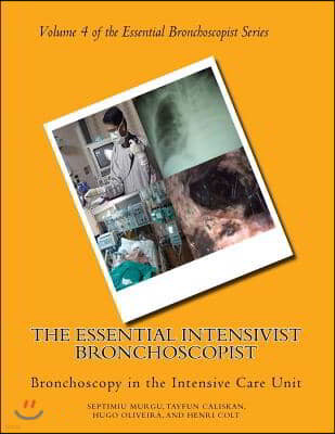 The Essential Intensivist Bronchoscopist: Bronchoscopy in the Intensive Care Unit