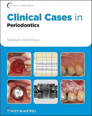 Clinical Cases in Periodontics