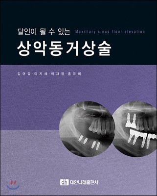 달인이 될 수 있는 상악동거상술 