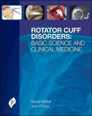 Rotator Cuff Disorders