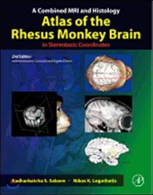 A Combined MRI and Histology Atlas of the Rhesus Monkey Brain in Stereotaxic Coordinates