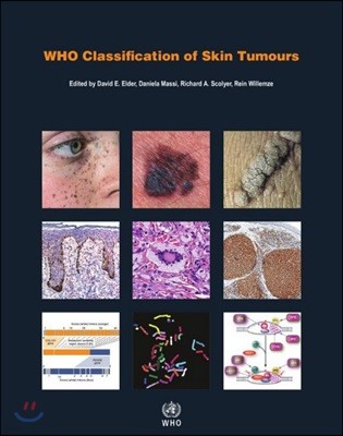 WHO Classification of Skin Tumours, 4/E