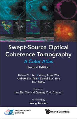 Swept-Source Optical Coherence Tomography: A Color Atlas (Second Edition)