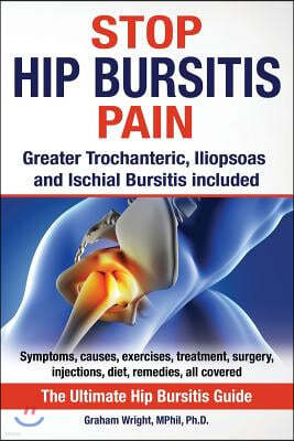 Stop Hip Bursitis Pain: Greater Trochanteric, Iliopsoas and Ischial Bursitis