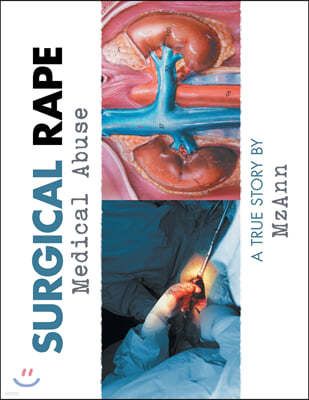 Surgical Rape: Medical Abuse
