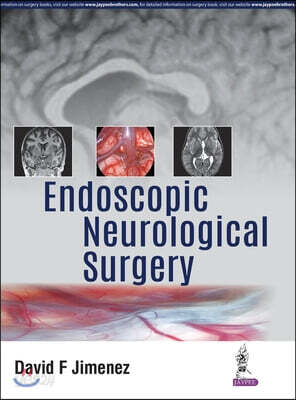 Endoscopic Neurological Surgery