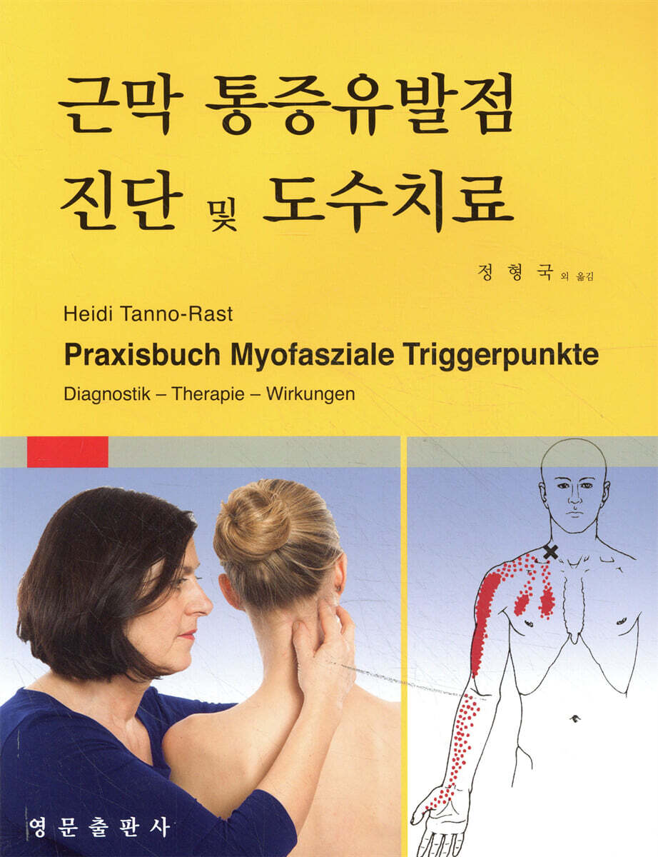근막 통증유발점 진단 및 도수치료