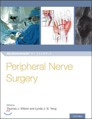 Peripheral Nerve Surgery